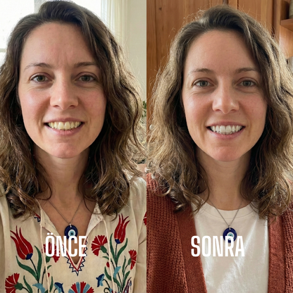 5D Diş Temizleme Bakım Paketi