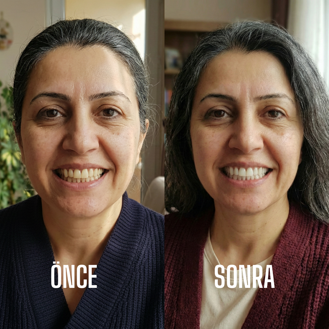 5D Diş Temizleme Bakım Paketi